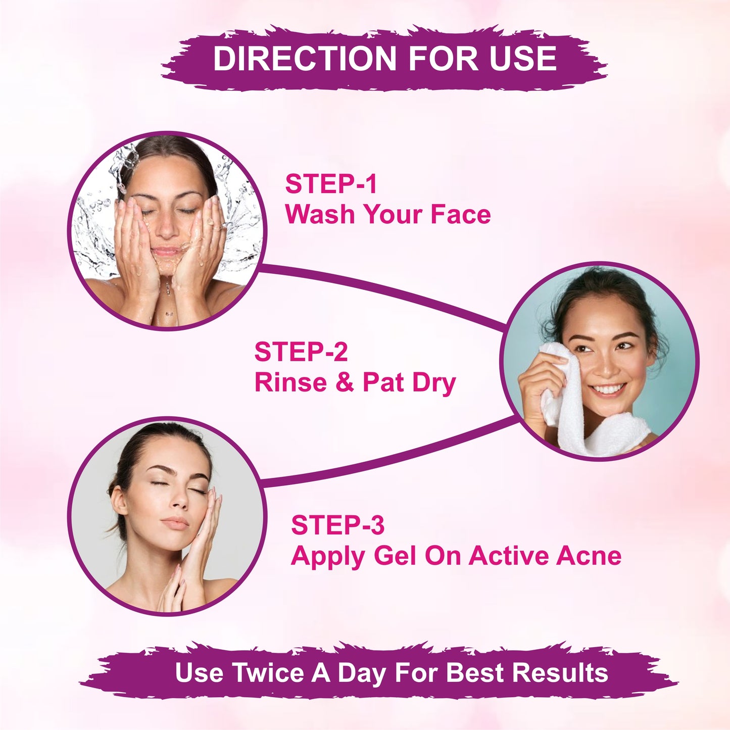 Acnetas Gel For The Treatment Of Acne And Pimple Pack Of (20gm) Each (2)