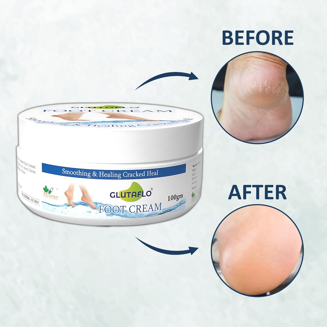 Glutaflo Foot Cream For Rough, Dry and Cracked Heel, Feet Cream For Heel Repair With Benefits of Urea, Lactic Acid and Vitamin E All Skin Types 100 Gm.