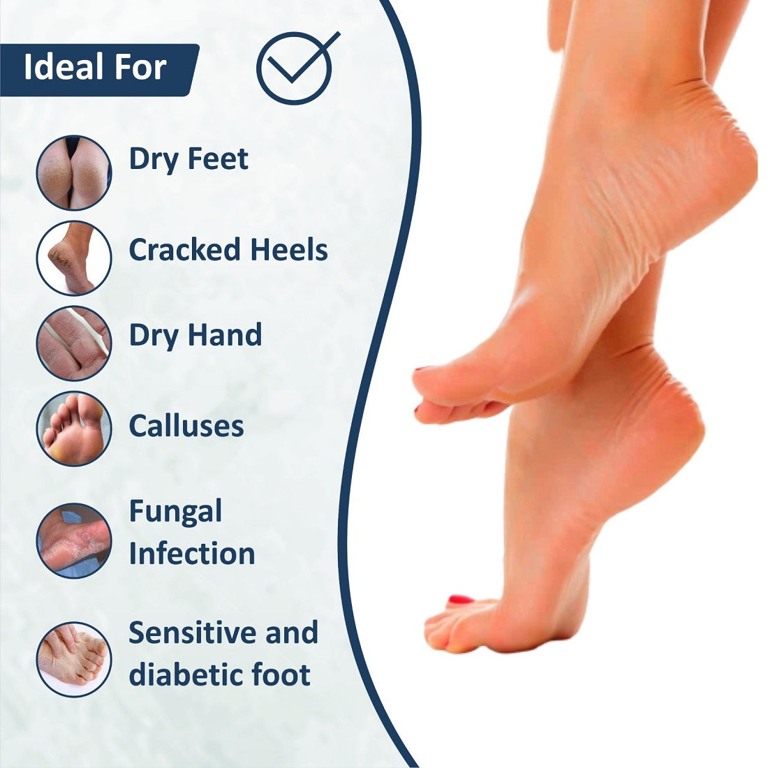 Glutaflo Foot Cream For Rough, Dry and Cracked Heel, Feet Cream For Heel Repair With Benefits of Urea, Lactic Acid and Vitamin E All Skin Types 100 Gm.